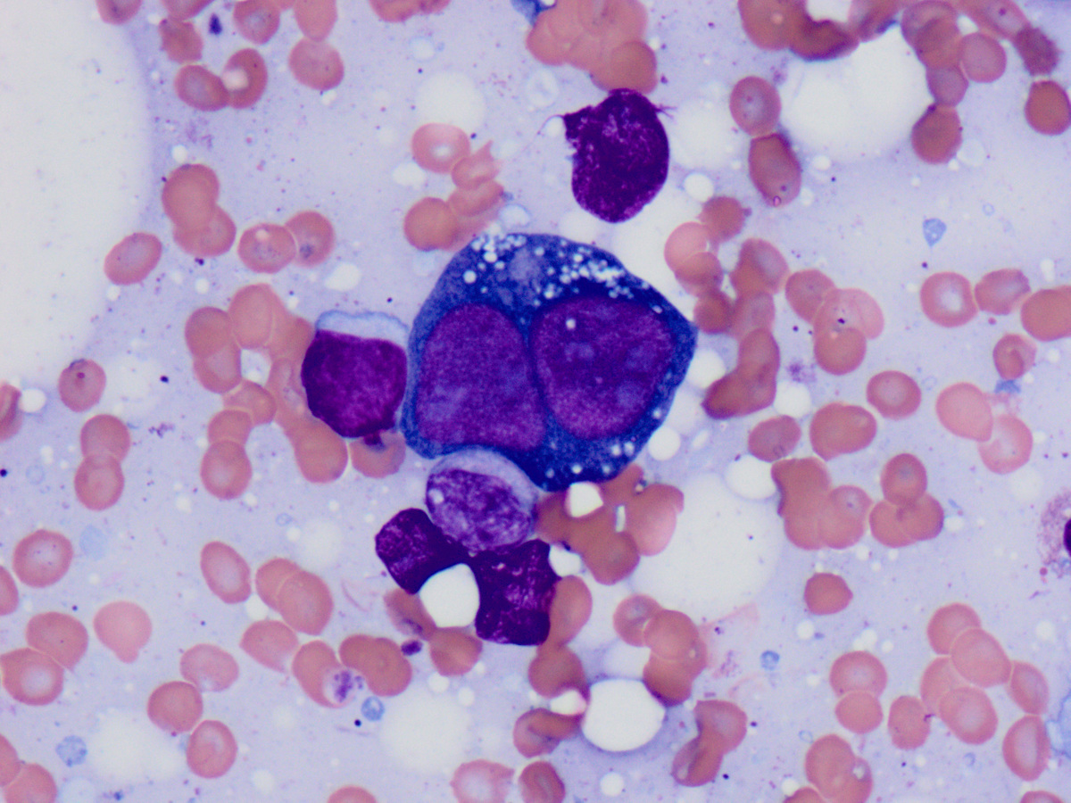 Bone marrow touch preparation 100x